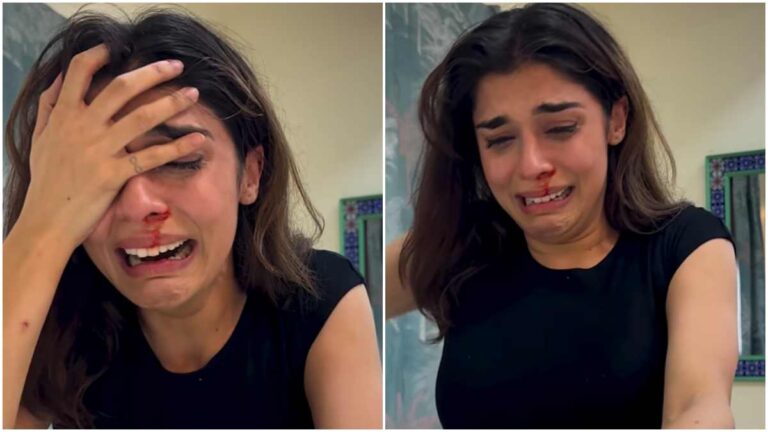 Eisha Singh का खून से लथपथ वीडियो देख घबराए फैंस, एक्ट्रेस ने खुद किया सच का खुलासा